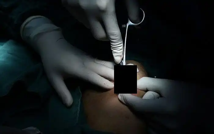 Нетрадиционное лечение от китайского лекаря