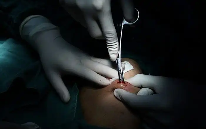 Нетрадиционное лечение от китайского лекаря