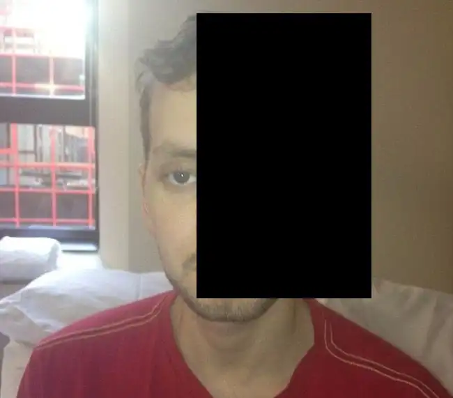 Необычная операция на черепе жертвы аварии