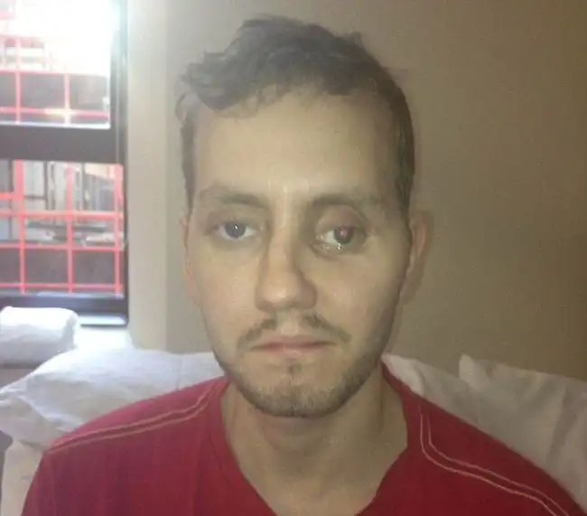 Необычная операция на черепе жертвы аварии