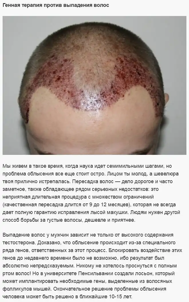 Вероятные изменения человеческого тела в будущем