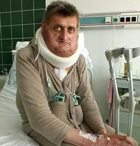 Хирурги срезали с шеи мужчины 6-килограммовый воротник