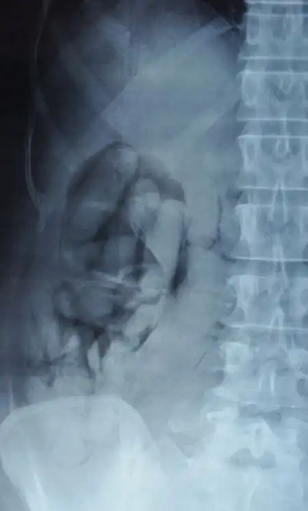 Необычные способы контрабанды наркотиков