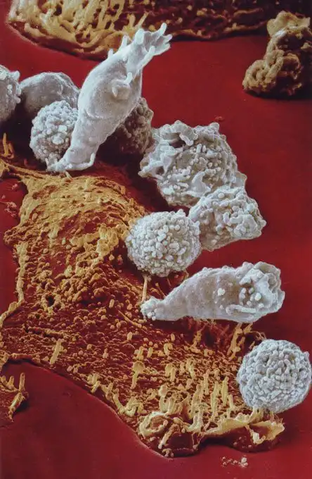 Наша невероятная иммунная система в микрофотографиях