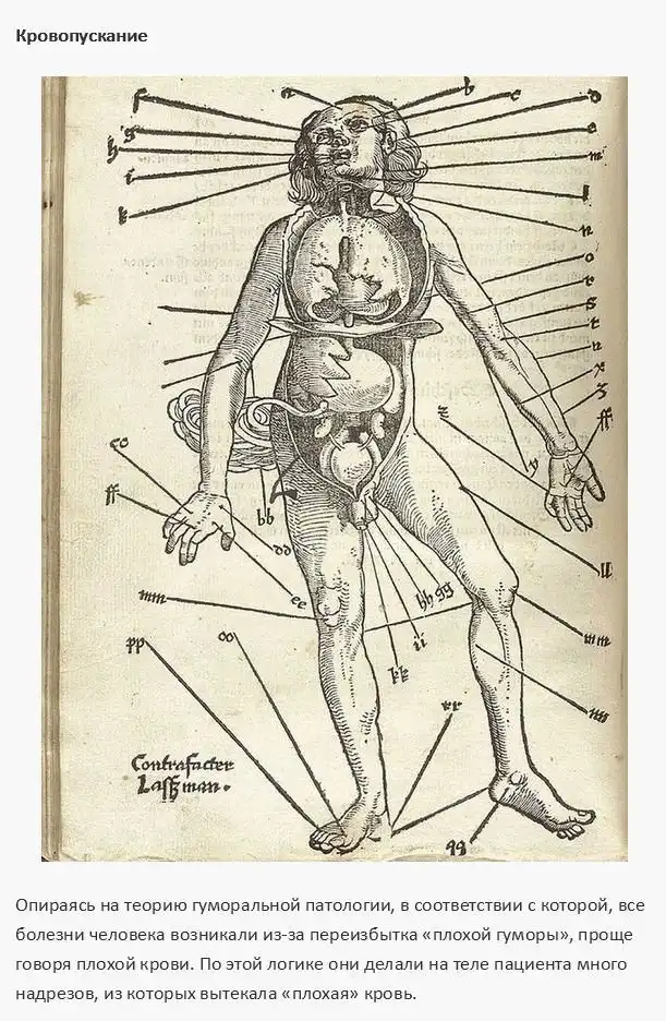 Опасные методы лечения из прошлого