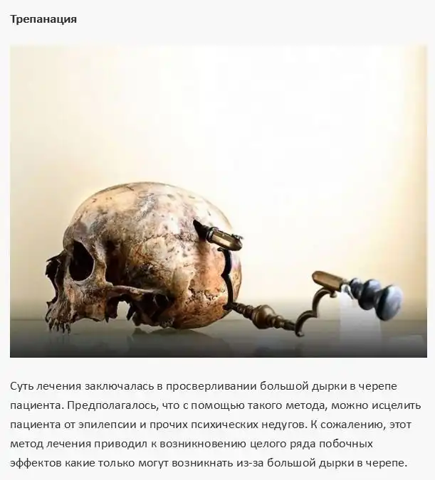 Опасные методы лечения из прошлого