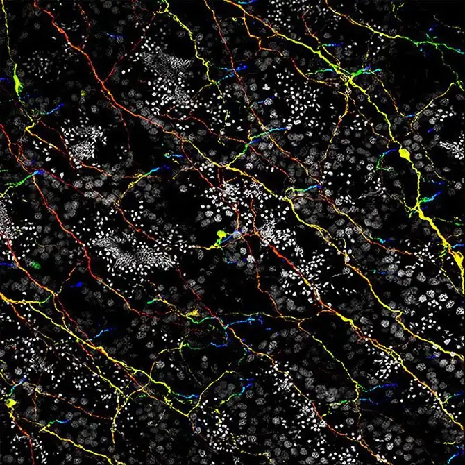 luchshie-fotografii-s-konkursa-nikon-small-world-2014