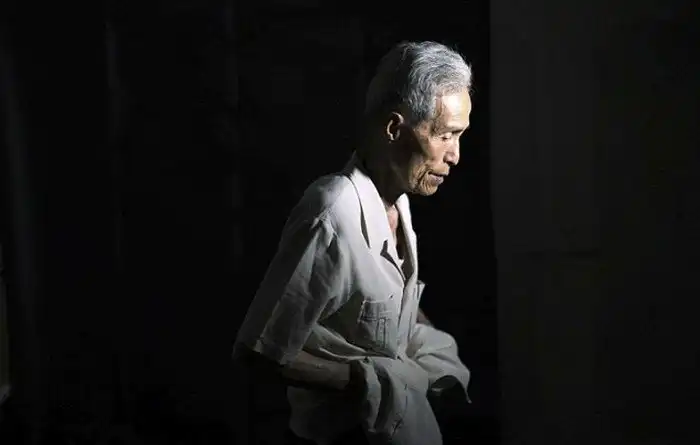 Последствия ядерного удара по Нагасаки на теле 86-летнего пенсионера