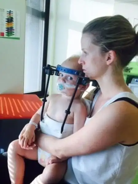 Австралийские врачи спасли жизнь ребенку, которому практически полностью оторвало голову в ДТП