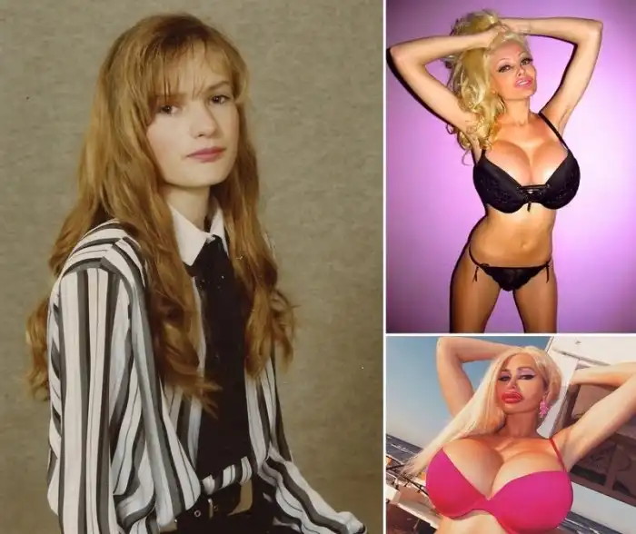 Любительница пластической хирургии Виктория Уайлд обзавелась новой пятой точкой