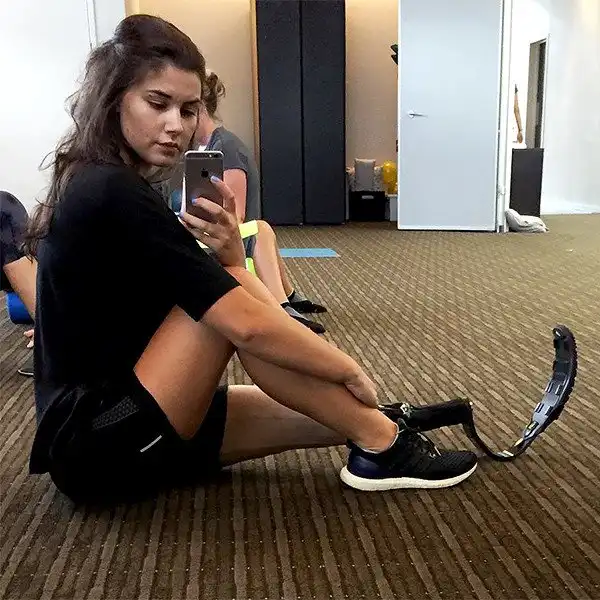 Одноногая манекенщица Джесси Куинн покорила модный бизнес