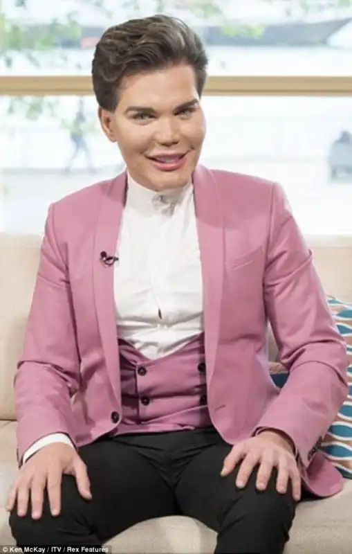 Живой Кен завязал с пластикой, когда чуть не остался без носа после 43 операций