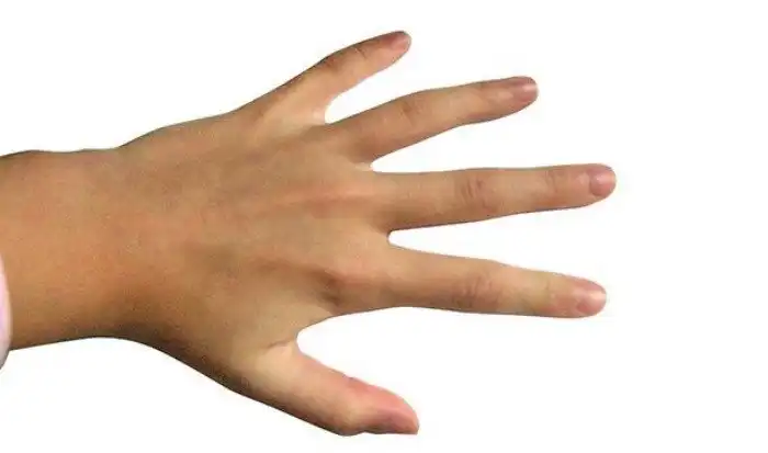 Интересные факты про опорно-двигательный аппарат, которые вы могли не знать