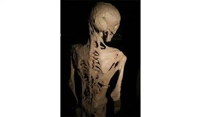 Интересные факты про опорно-двигательный аппарат, которые вы могли не знать