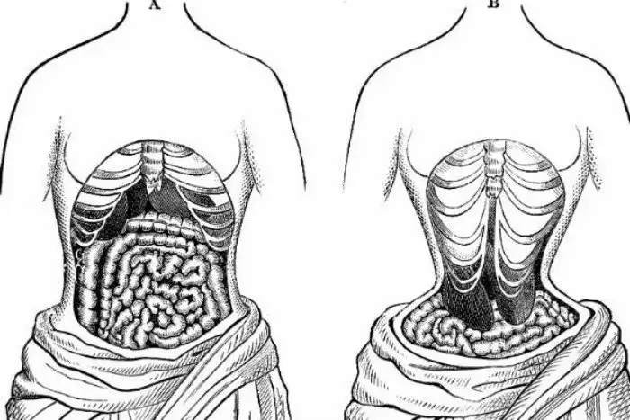 15 самых странных «писков» в истории моды
