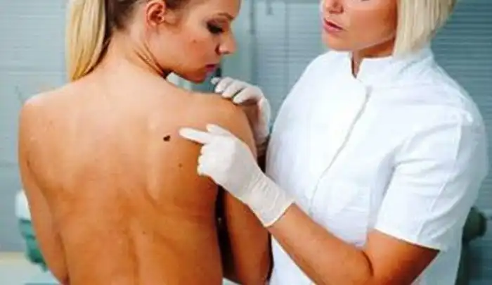 Неожиданные факты про загар и солярии, которые вы могли не знать