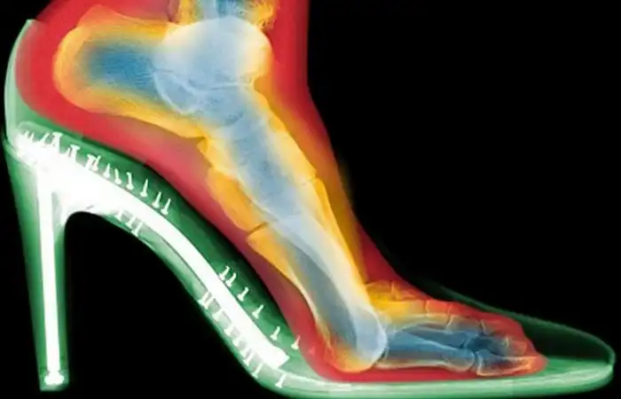 10 старомодных тенденций, которые сегодня кажутся абсолютно безумными