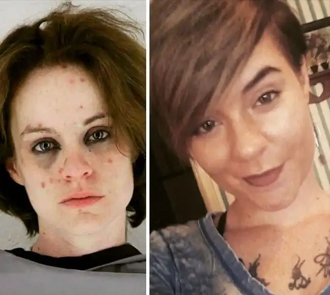 Преображения бывших наркоманов