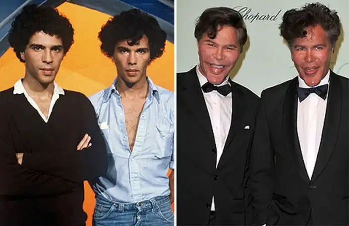 Жертвы пластической хирургии: близнецы Богдановы, которые уже не могут остановиться