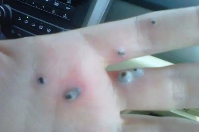 Мужчина заметил странные черные точки на руке жены. Оказалось, что это...