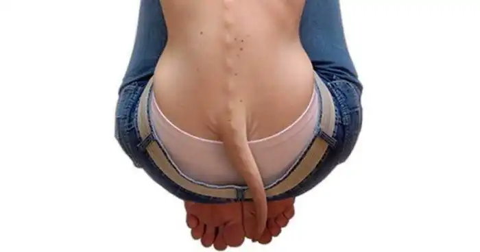 Мутации, которые шокируют даже врачей