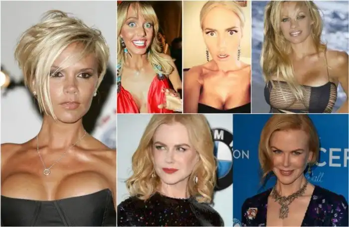 Грудь: туда и обратно. Звезды, которые не могли определиться с размером