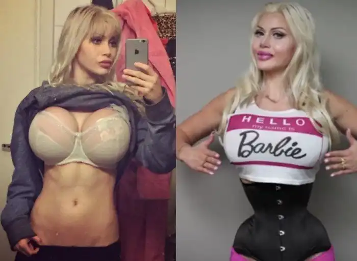 Пикси Фокс: девушка-барби