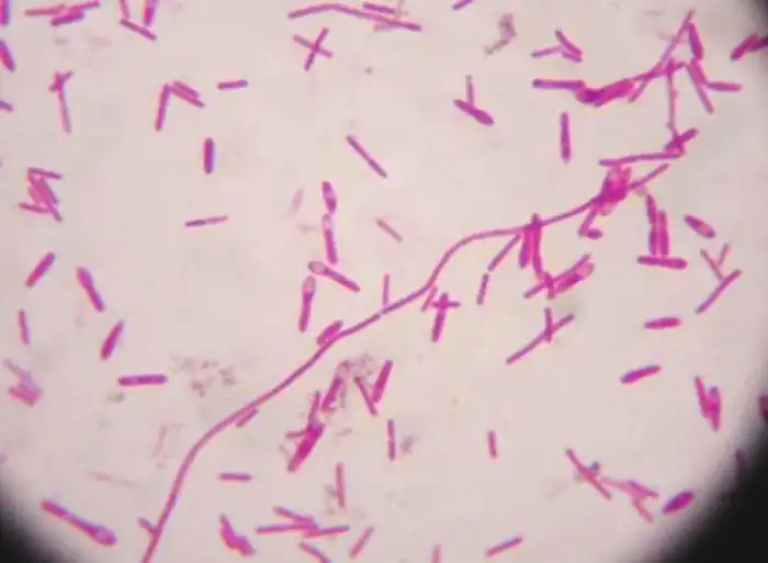 Самые опасные известные науке яды