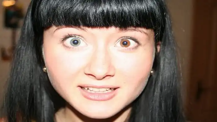 Любопытное о глазах