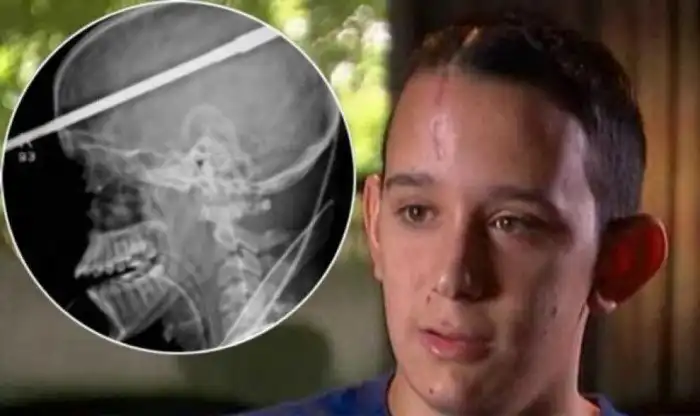 Истории людей, чудом выживших после несчастных случаев