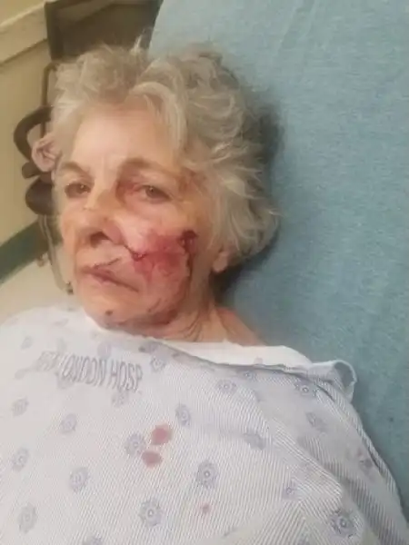 Старушке не посчастливилось встретиться с бешеной рысью