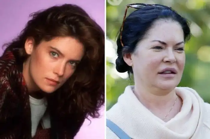 Известные люди, доигравшиеся с ботоксом