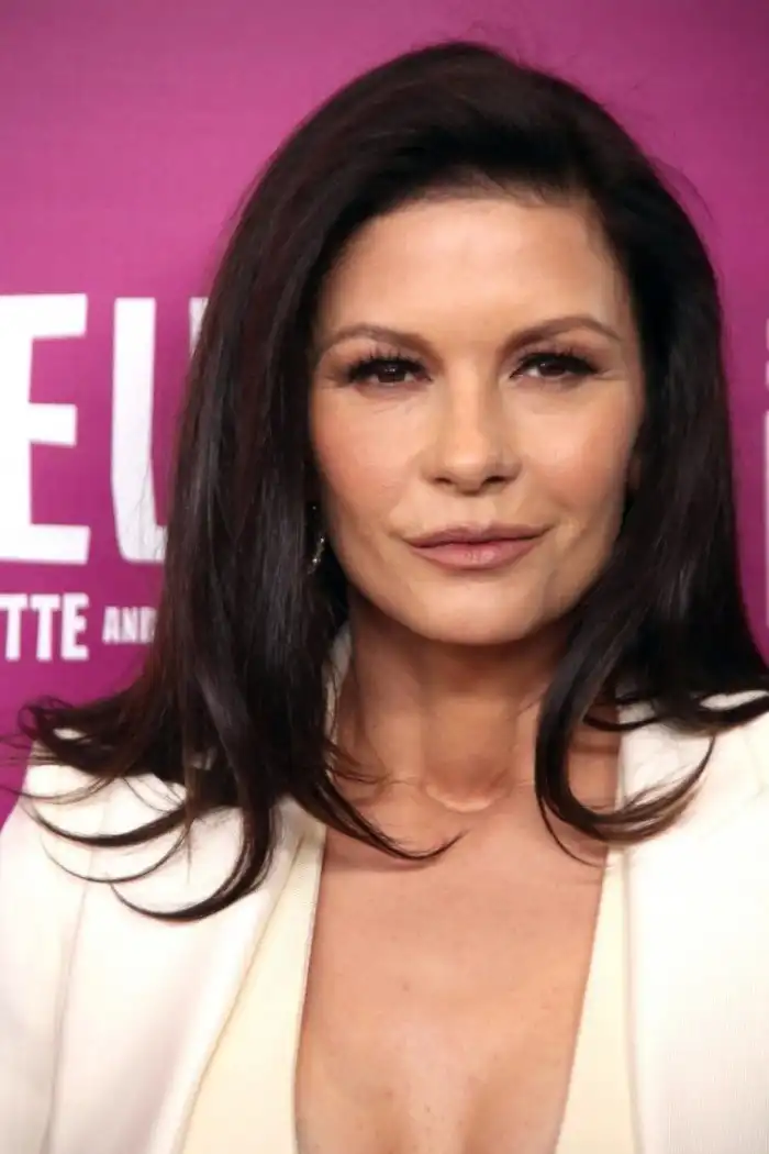 Известные люди, доигравшиеся с ботоксом