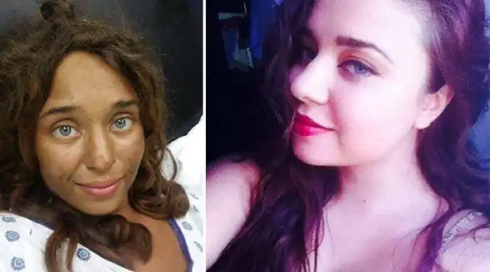 25-летняя студентка месяц питалась грибами и ягодами, блуждая одна в лесу