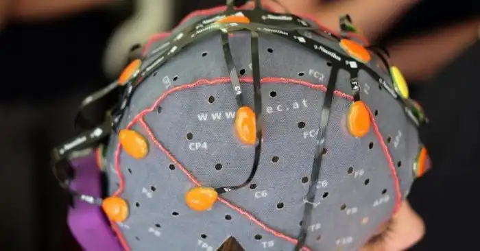 9 удивительных фактов о человеческом мозге