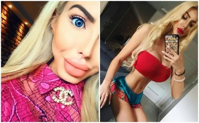 Полячка стала "живой барби", потратив на пластику 40 тысяч долларов