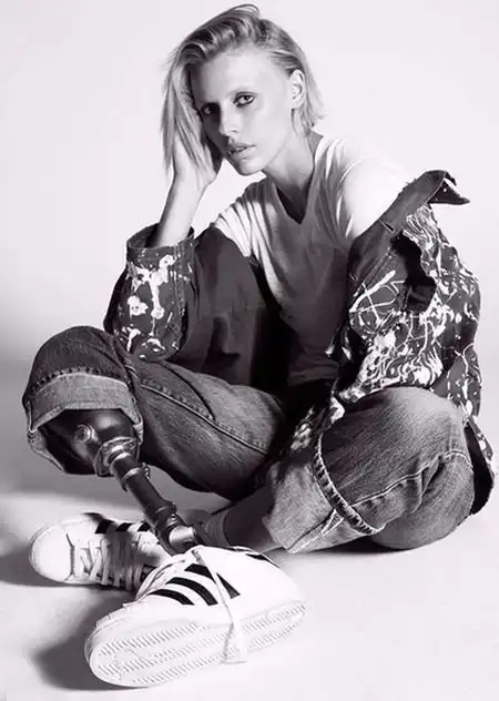 Американская модель лишилась ноги из-за использования тампона