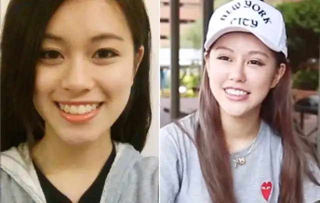 Китаянка сделала более 30 пластических операций ради парня, но он ее бросил