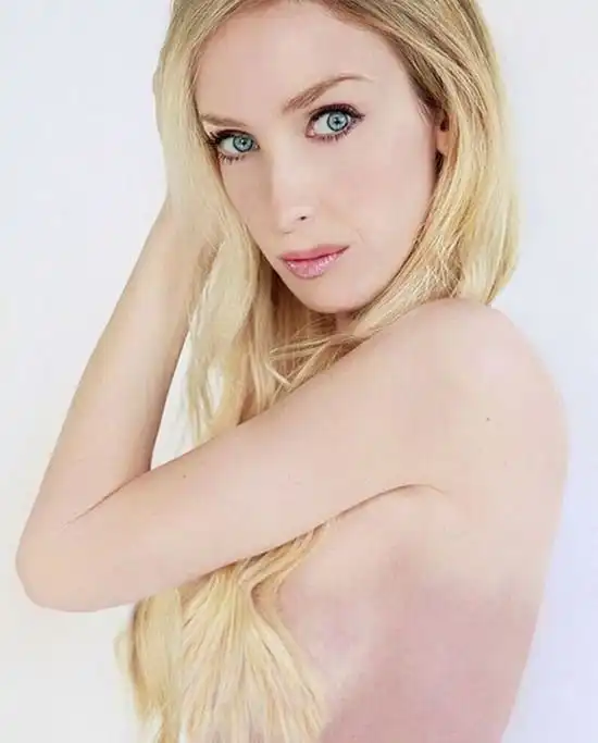 Тейлор Мул - девушка с разным набором генов