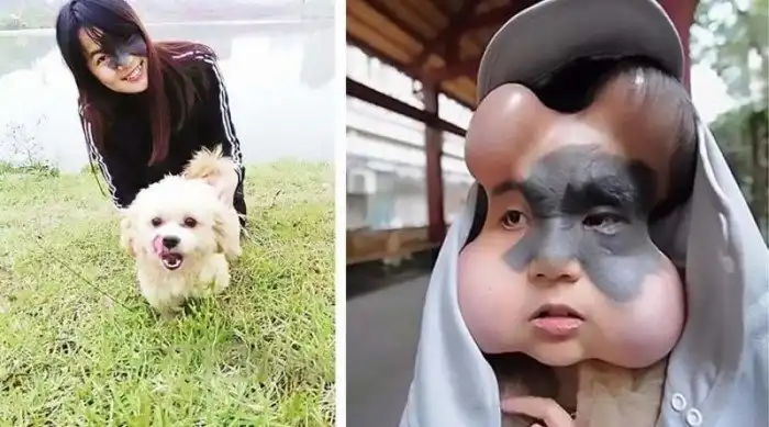 Девушке буквально накачали голову имплантами, чтобы удалить родимое пятно