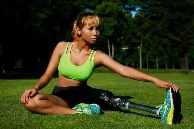 Ампутированная нога – не повод оставить подиум