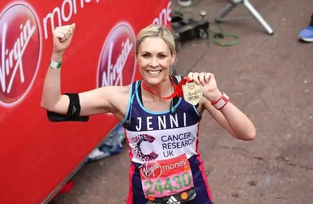 Британская телеведущая Дженни Фалконер показала последствия редкого заболевания