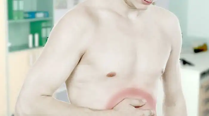 Первые признаки начальной стадии язвы желудка