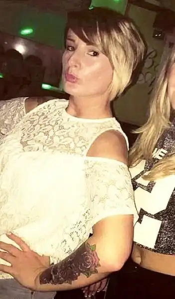 Невеста горько пожалела о решении удалить татуировку лазером перед свадьбой