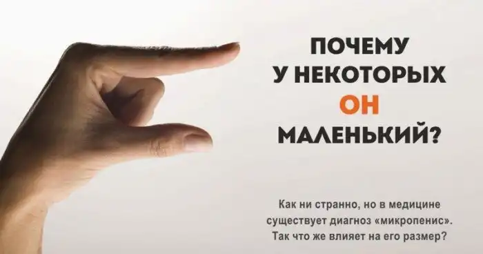 10 больших фактов о маленьких членах