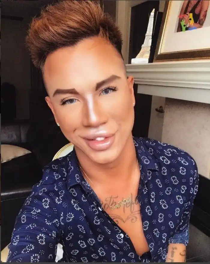 Парни, прекратите накачивать губы