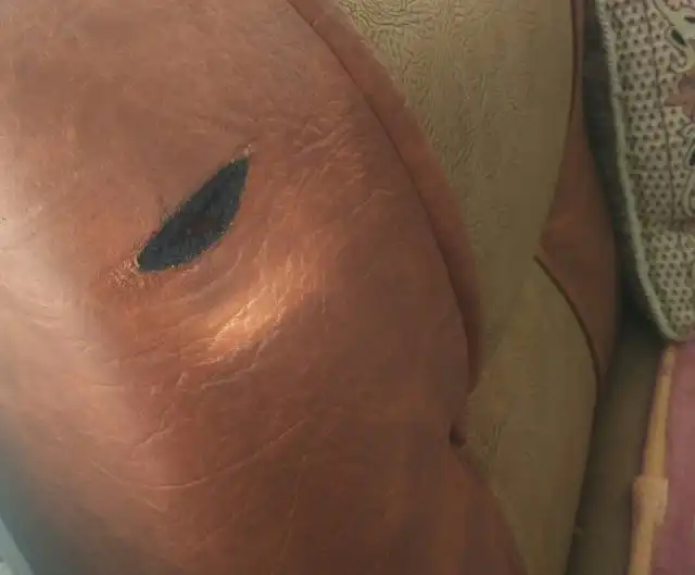 Возгорание кухонного дивана