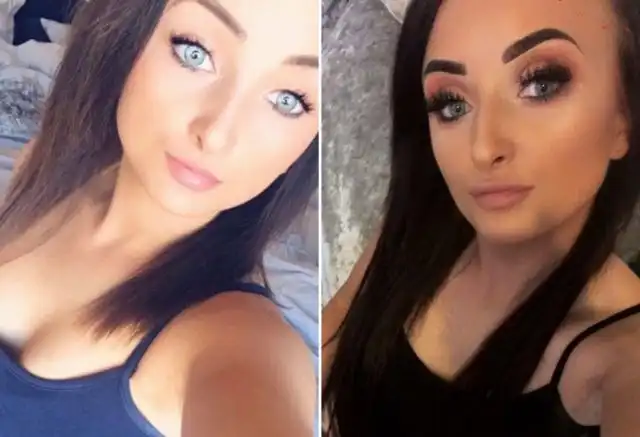 Девушка всегда хотела "пухленькие губки", но все пошло совсем не так