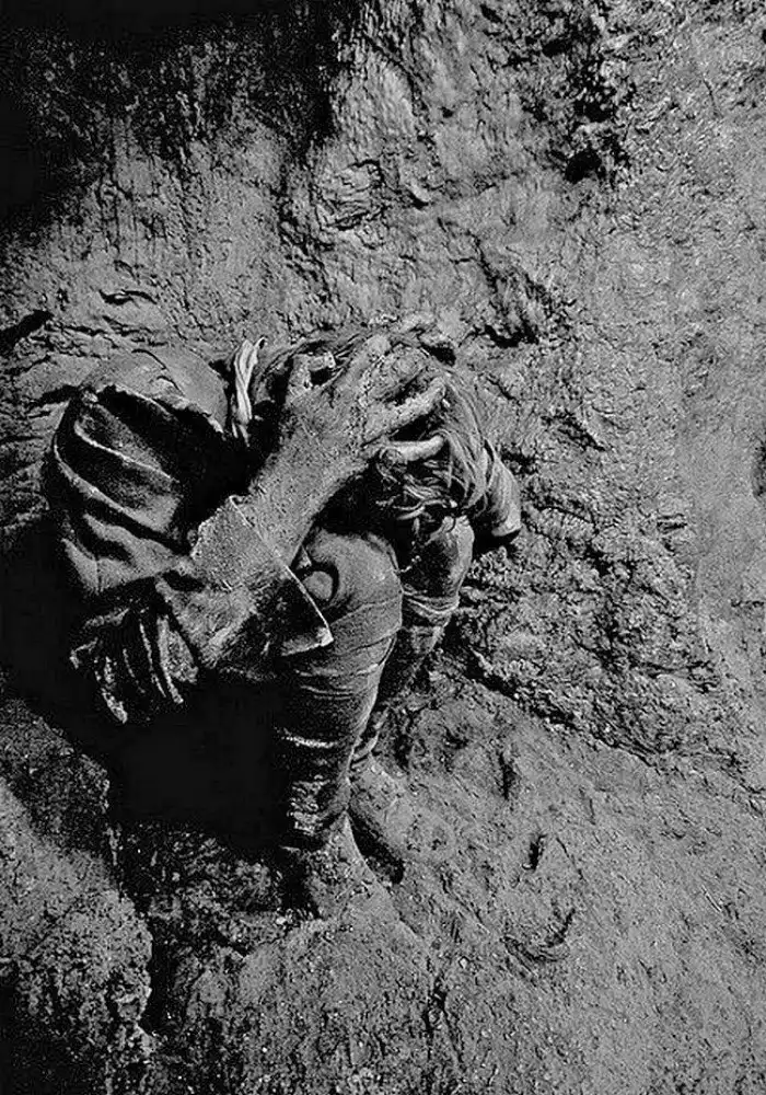 Что такое контузия?