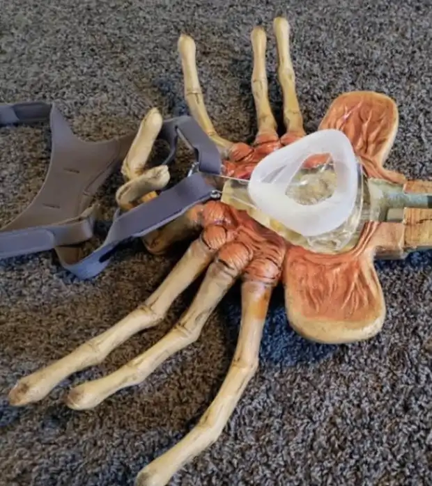 Креативный подход к оборудованию для борьбы с остановкой дыхания во сне